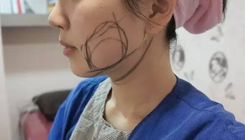 哈尔滨欧兰仁美医院:全面部填充一次体验 即可定格面部美丽