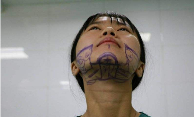 哈尔滨欧兰仁美医院:全面部填充一次体验 即可定格面部美丽