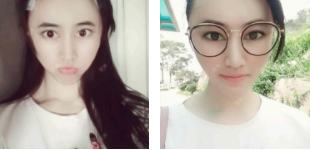 “整形上瘾”怎么办, 青岛诺德真人粉丝现场说法!