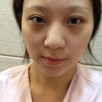 整形前后对比图片