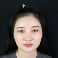 整形前后对比图片