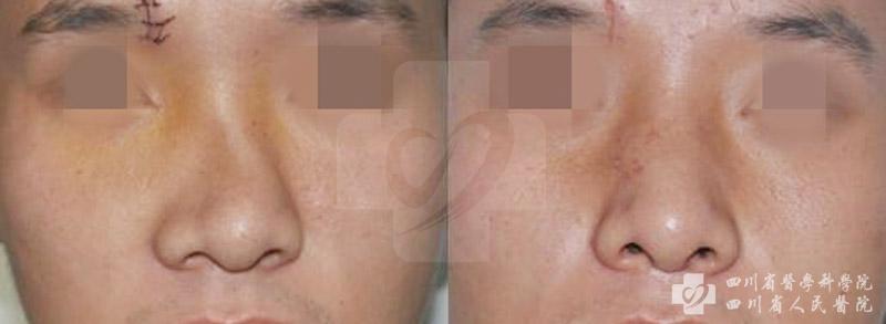 QQ截图20180119092357