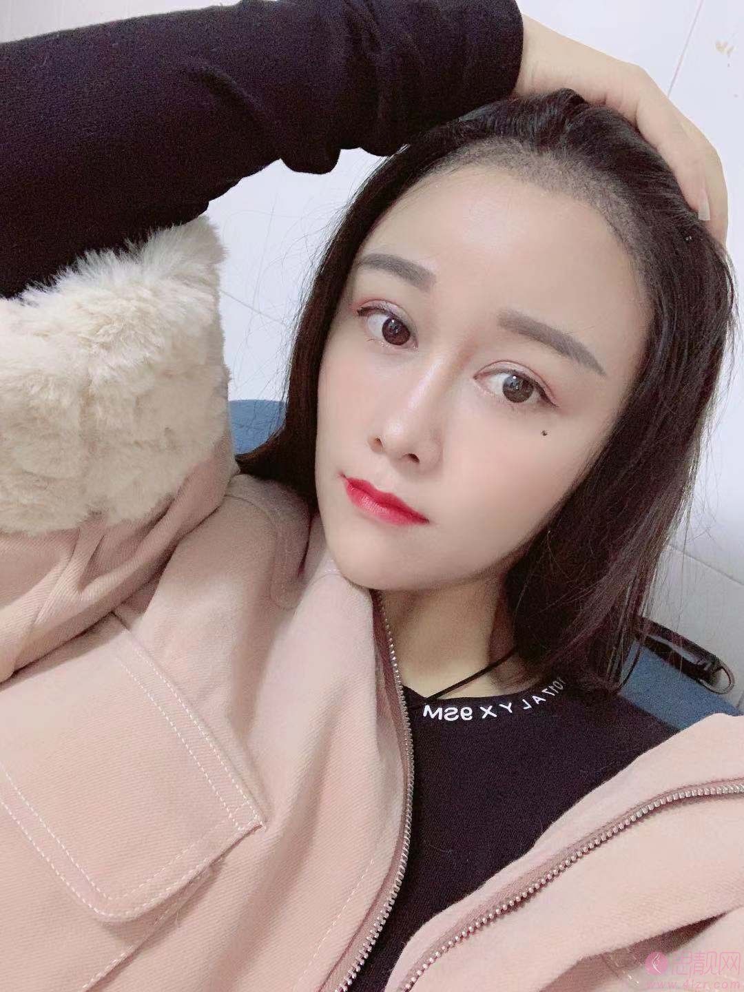 碧莲盛和雍禾哪个技术好？价格表曝光+真实案例效果对比