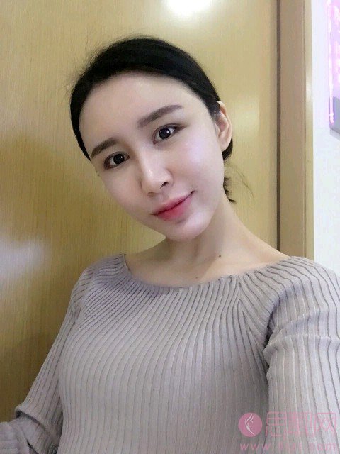 常双明脂肪填充怎么样?附案例及2021年全新价格表公开