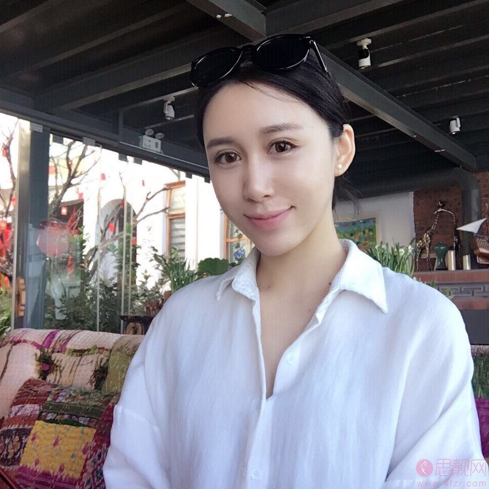 常双明脂肪填充怎么样?附案例及2021年全新价格表公开