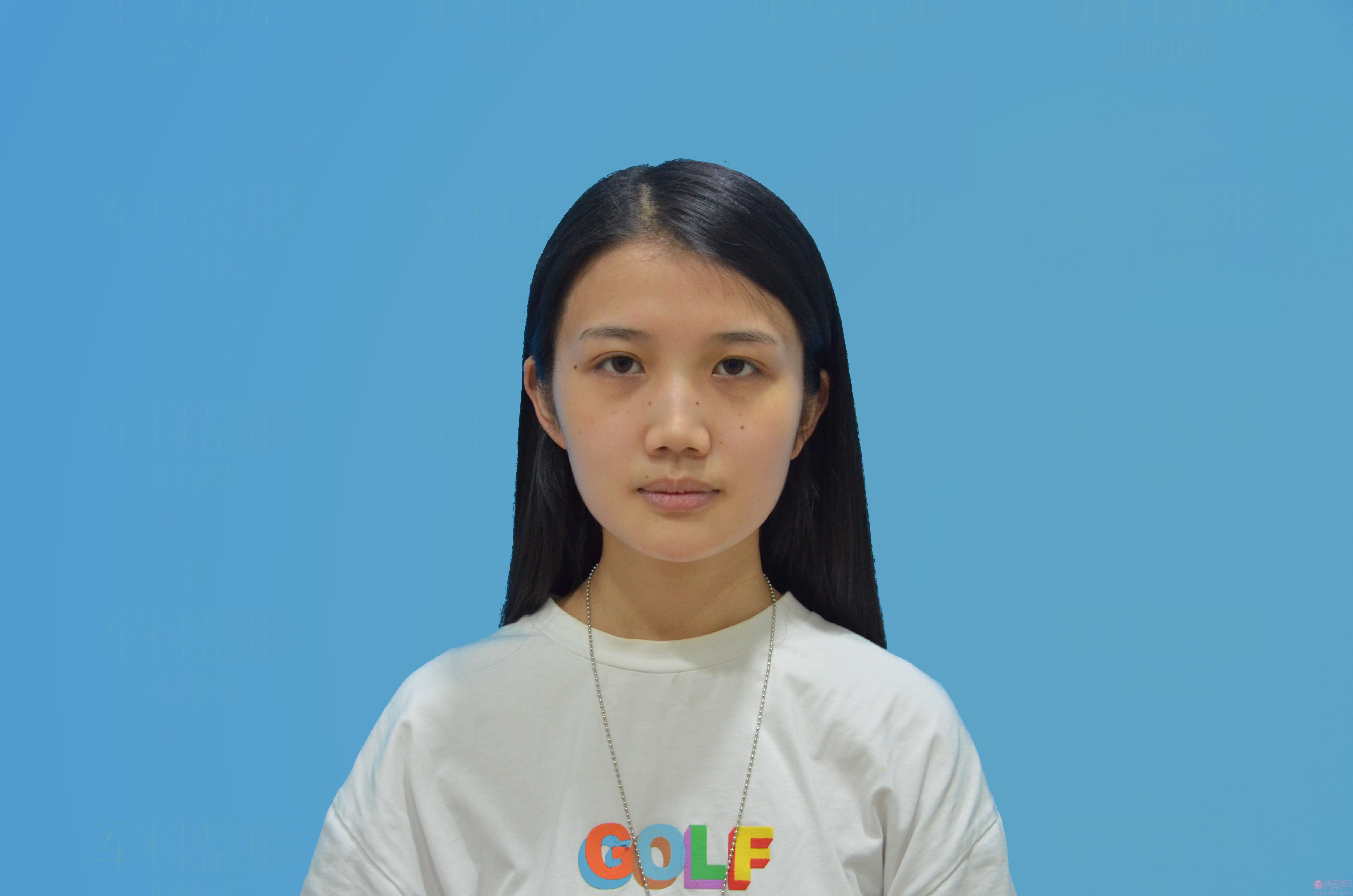 重庆军科整形美容医院是正规医院吗?附医院介绍+隆鼻真人案例分享