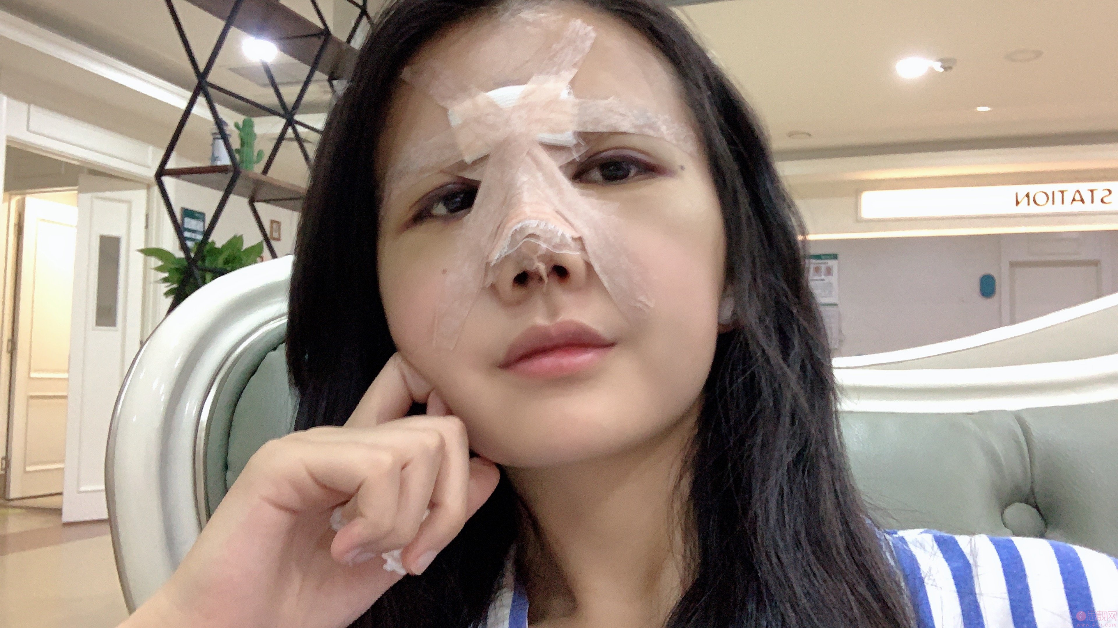 重庆军科整形美容医院是正规医院吗?附医院介绍+隆鼻真人案例分享