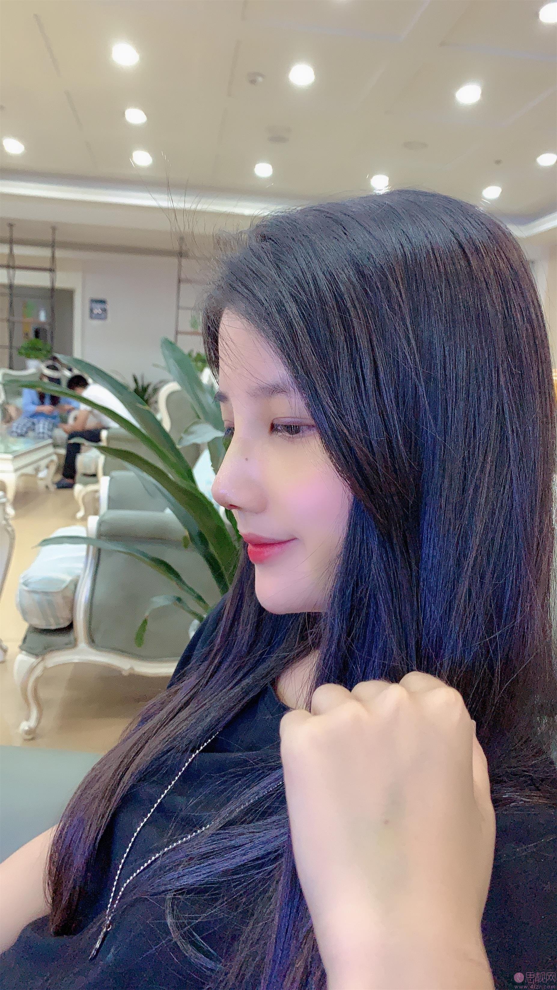 重庆军科整形美容医院是正规医院吗?附医院介绍+隆鼻真人案例分享