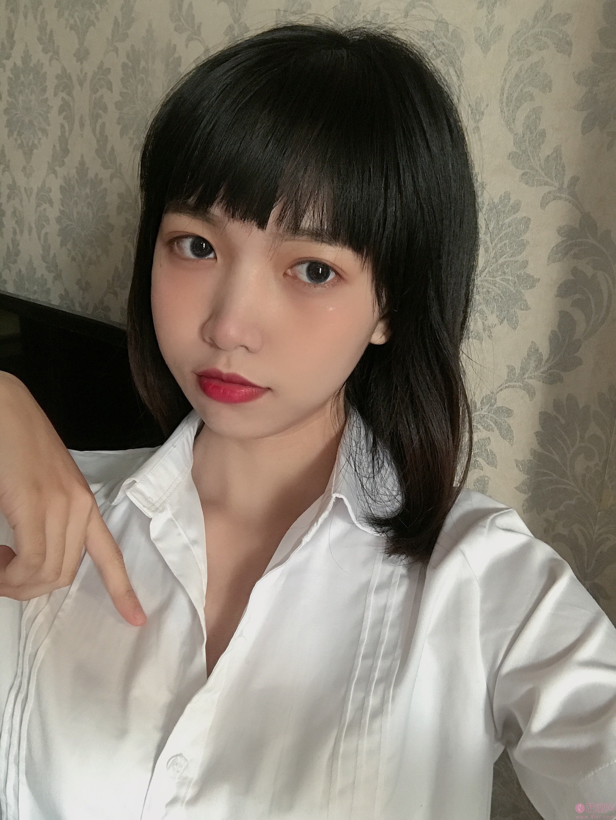 重庆医佑美曾志权医疗美容曾志权颧骨内推怎么样?附案例及2021年价格表曝光