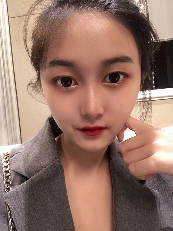 张立天做下颌角怎么样?附术后真人案例分享+2021价格表曝光 张立天做下颌角怎么样?附术后真人案例分享+2021价格表曝光