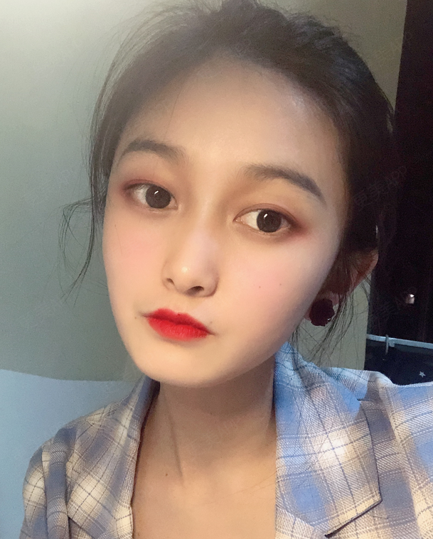 张立天做下颌角怎么样?附术后真人案例分享+2021价格表曝光 张立天做下颌角怎么样?附术后真人案例分享+2021价格表曝光