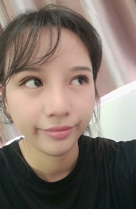 田国静修复双眼皮价格?2021价格表曝光+眼修复案例反馈 田国静修复双眼皮价格?2021价格表曝光+眼修复案例反馈