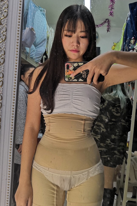 王志军医生吸脂怎么样?附腰腹吸脂案例及2021价格表一览 王志军医生吸脂怎么样?附腰腹吸脂案例及2021价格表一览