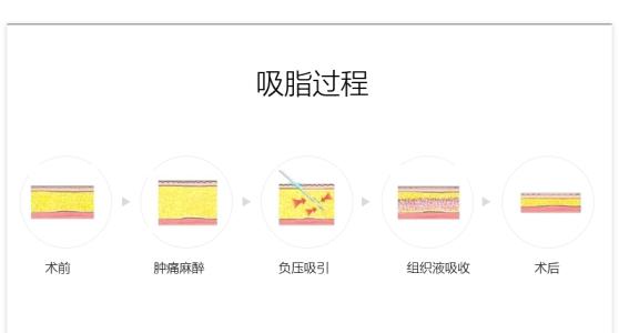 5d3fbe92088c0.jpg 01300000329092156393510011503.jpg