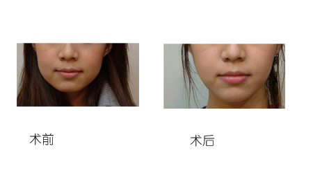 5d499634e6a36.jpg timg (2).jpg