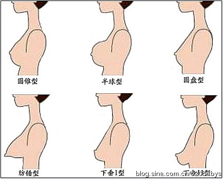 完美乳房的类型 完美乳房的类型