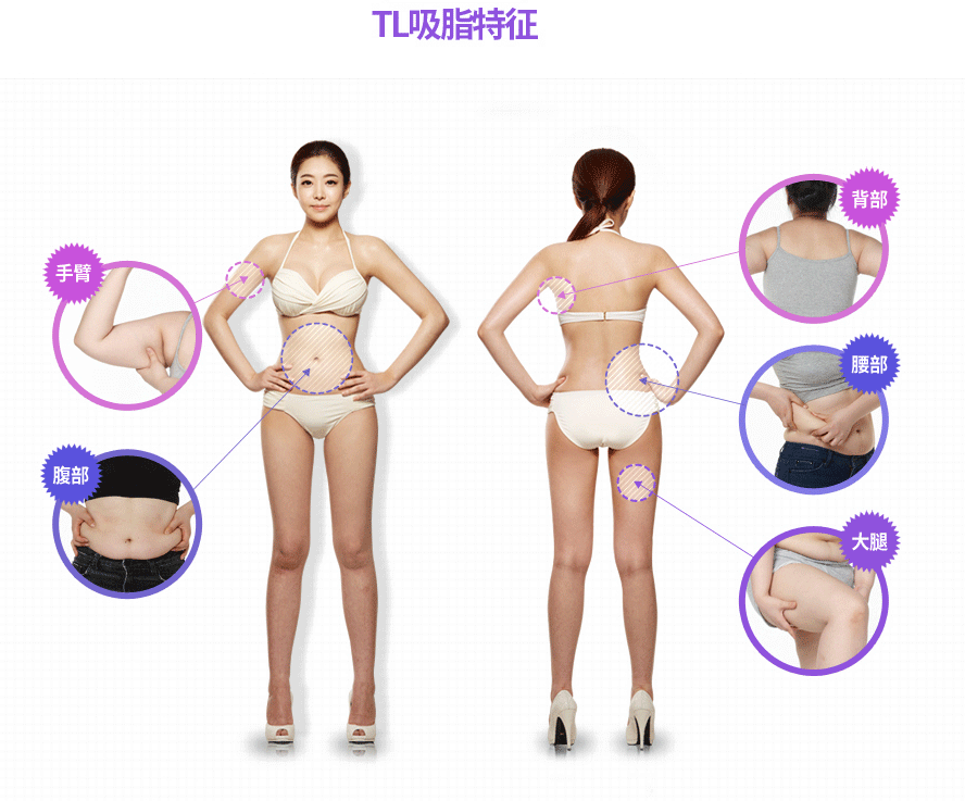 韩国TL整形医院吸脂案例 韩国TL整形医院吸脂案例