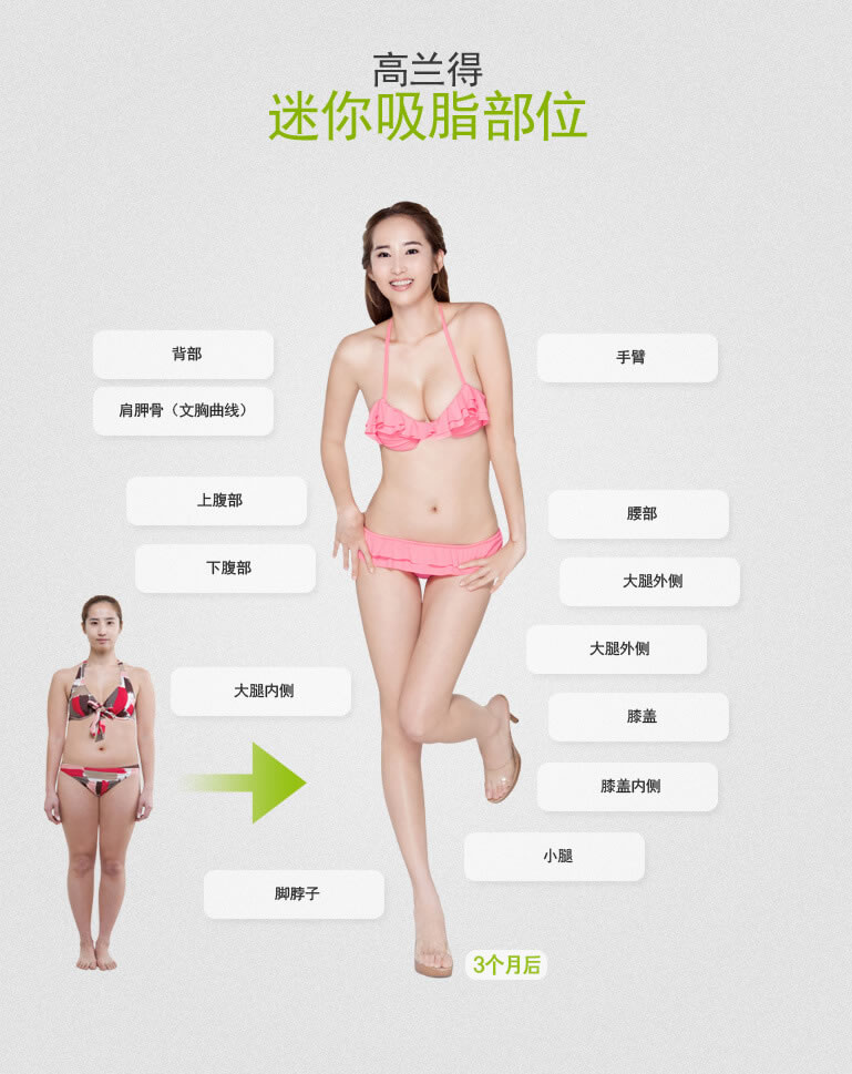 韩国高兰得整形医院 独创三倍冲击吸脂术 韩国高兰得整形医院 独创三倍冲击吸脂术