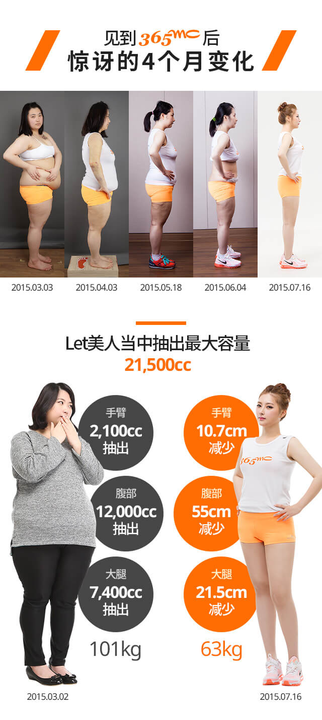 韩国365MC医院吸脂案例 韩国365MC医院吸脂案例