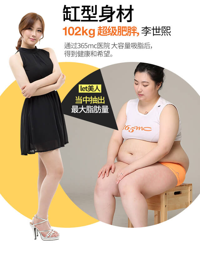 韩国的吸脂减肥医院 韩国的吸脂减肥医院