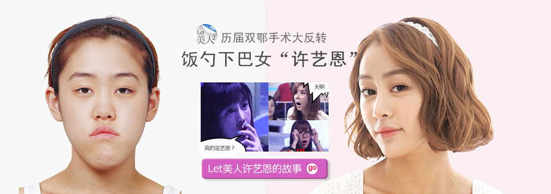 许誉恩案例对比图 许誉恩案例对比图