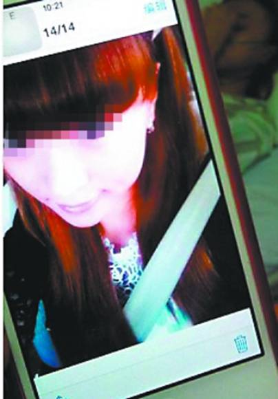 美女微整形隆鼻右眼失明 美女微整形隆鼻右眼失明