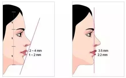 美丽下巴的定义 美丽下巴的定义