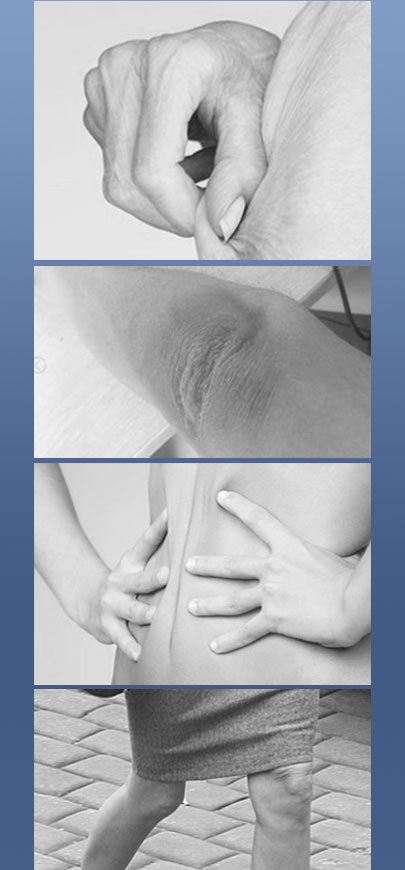 SHURINK适用人群 SHURINK适用人群