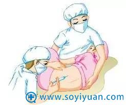 吸脂麻醉 吸脂麻醉