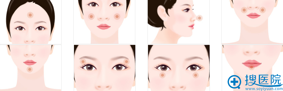 自体脂肪移植手术适宜人群 自体脂肪移植手术适宜人群