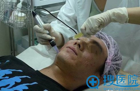 除皱手术 除皱手术