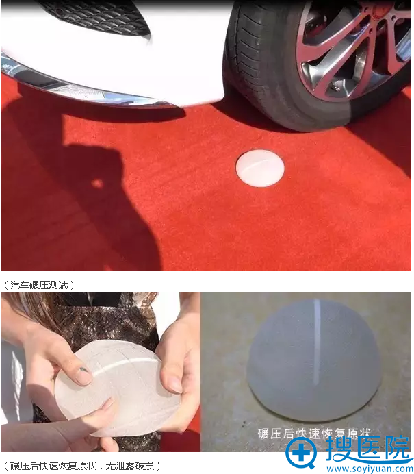 宝俪假体汽车碾压测试 宝俪假体汽车碾压测试