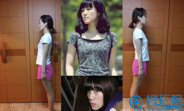 术前全方位照片 术前全方位照片