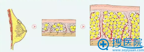 什么是自体脂肪编码植入技术 什么是自体脂肪编码植入技术