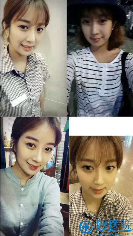 现在更加漂亮了,真的很感谢维多利亚整形医院 现在更加漂亮了,真的很感谢维多利亚整形医院