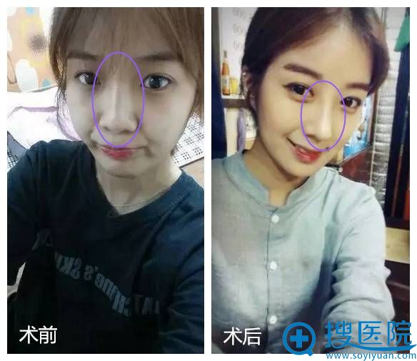 朋友们都说我美出了浓浓的“韩国范”,开心~ 朋友们都说我美出了浓浓的“韩国范”,开心~