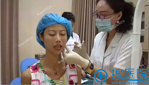 用玻尿酸填充了法令纹和鼻子 用玻尿酸填充了法令纹和鼻子