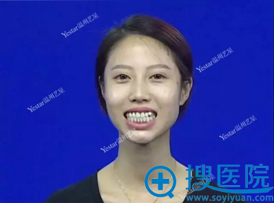 20170313113474.png blob.png