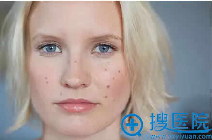 注射后长痘,长痤疮是副作用? 注射后长痘,长痤疮是副作用?