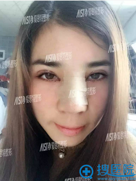 术后第二天,期待 术后第二天,期待