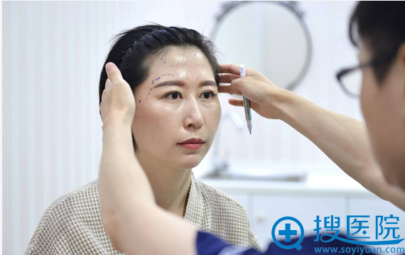 面部脂肪填充术前设计 面部脂肪填充术前设计