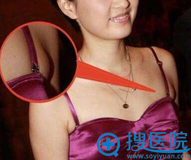 20171009_1507530206618338.png image.png