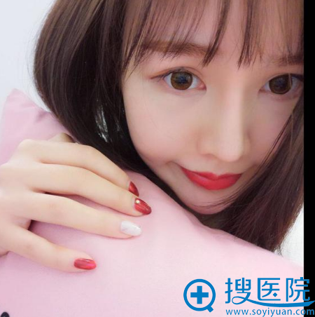 上海薇琳医美顾陆健做的隆鼻案例术后一个月效果图 上海薇琳医美顾陆健做的隆鼻案例术后一个月效果图