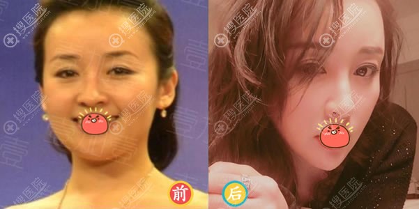 北京壹加壹田莹面部<span style= 北京壹加壹田莹面部<span style=