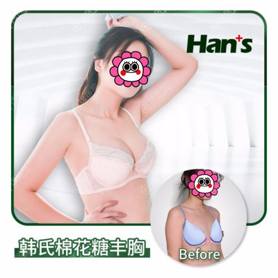 济南韩氏棉花糖丰胸真人案例 济南韩氏棉花糖丰胸真人案例