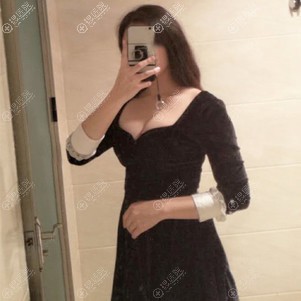 到沧州静港做自体脂肪隆胸后恢复三个月有了性感的乳沟 到沧州静港做自体脂肪隆胸后恢复三个月有了性感的乳沟