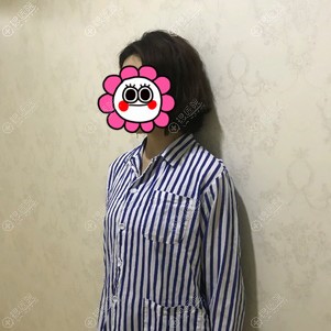 在泉州脂管加做自体脂肪丰胸前 在泉州脂管加做自体脂肪丰胸前