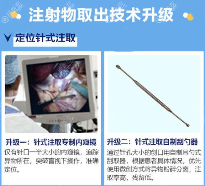 注射物取出术技术 注射物取出术技术