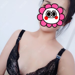 找韦元强做自体脂肪丰胸前 找韦元强做自体脂肪丰胸前