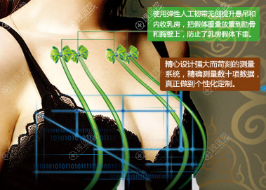 人工韧带无创提升效果 人工韧带无创提升效果